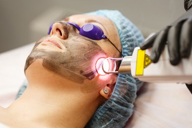 Laser Hair Removal